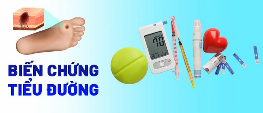 13 Biến chứng tiểu đường nguy hiểm và cách phòng ngừa an toàn