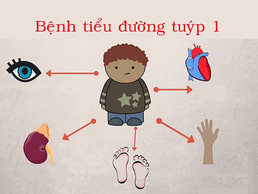 Tiểu đường tuýp 1: Dấu hiệu nhận biết và biến chứng nguy hiểm