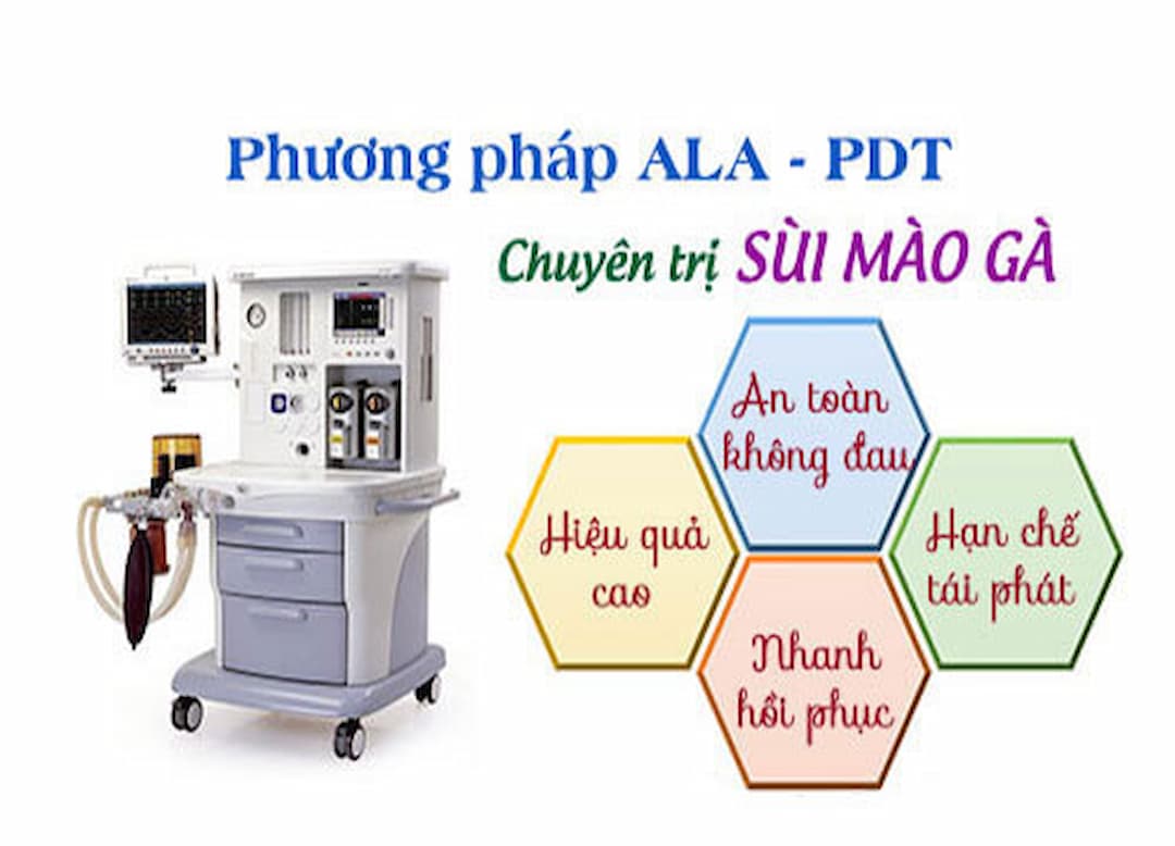 Phương pháp quang động học ALA PDT