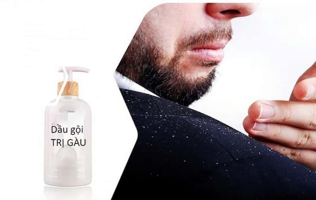 Tổng hợp dầu gội trị gàu cho nam