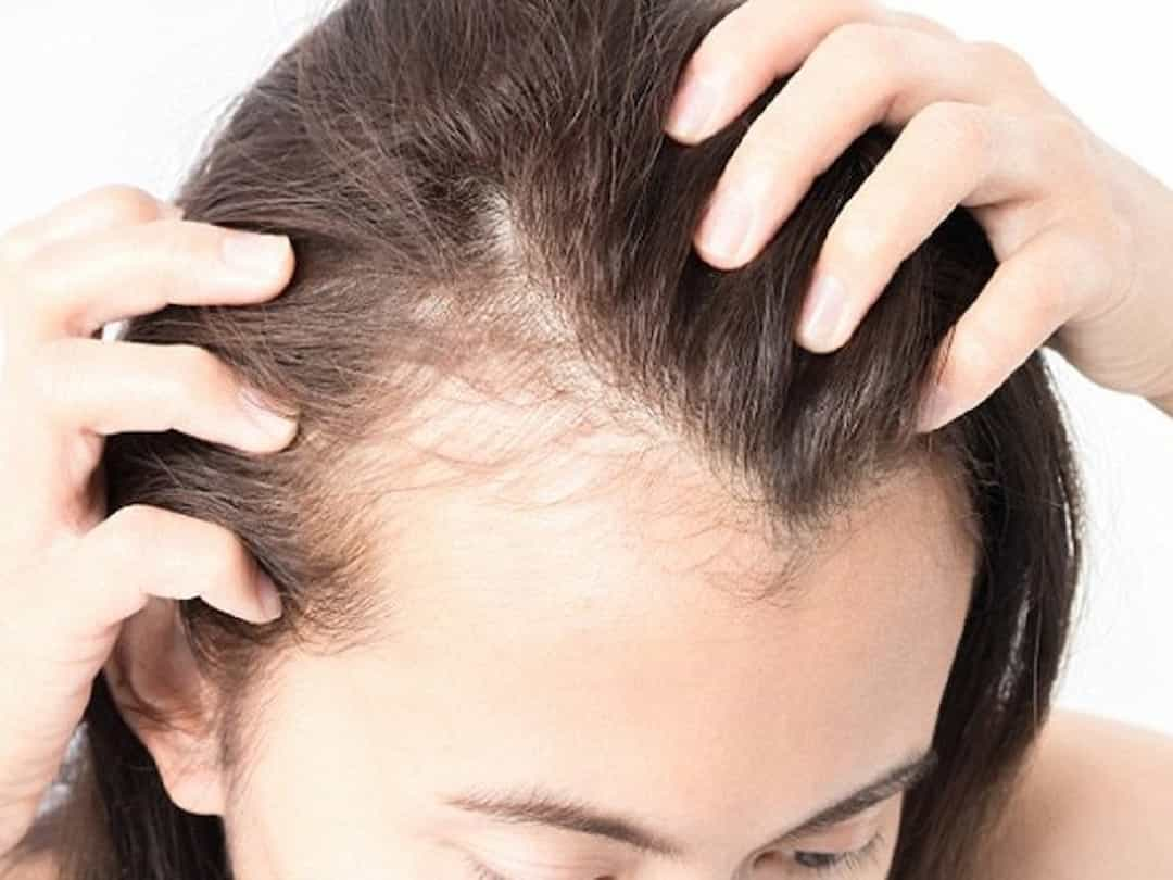 Tác hại của dầu gội trị gàu